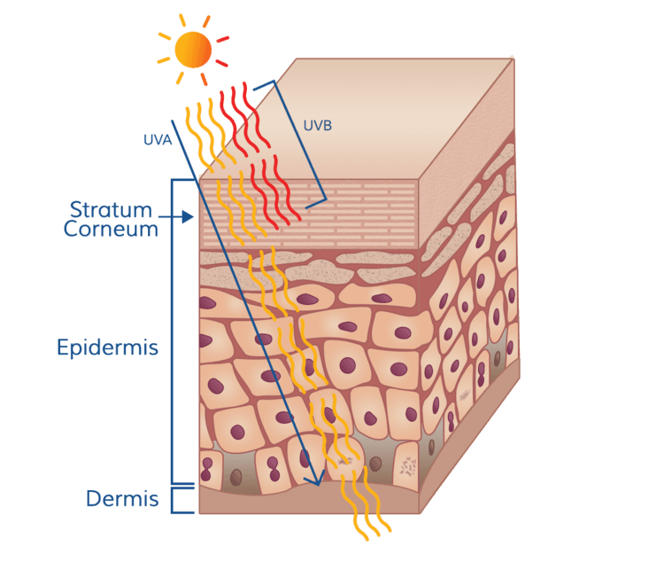 UV radiation and skin